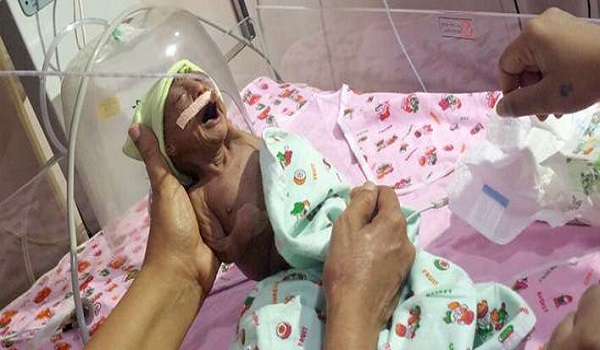 Γονείς ΤΕΡΑΤΑ εγκατέλειψαν αβοήθητο το νεογέννητο παιδί τους επειδή είχε ρυτίδες [εικόνες & βίντεο]